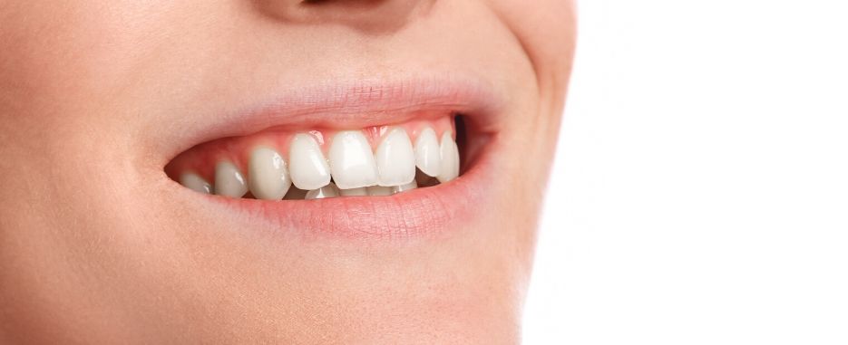 cuanto tardara en cicatrizar un implante dental
