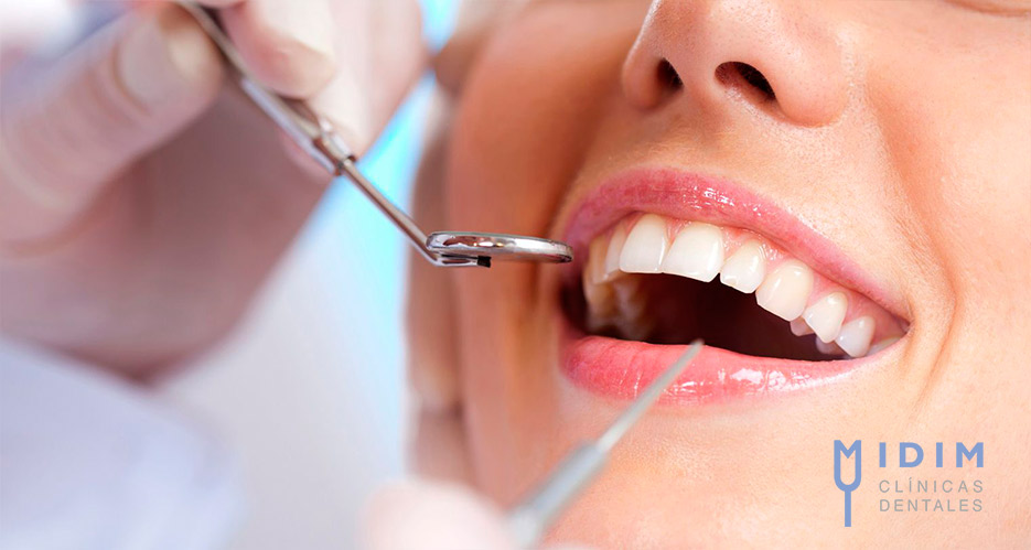 Donde ponerse implantes dentales en Valencia Capital