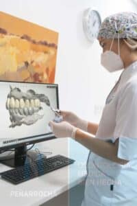 especialista en protesis implantes subperiosticos idim clinica de implantes dentales en valencia