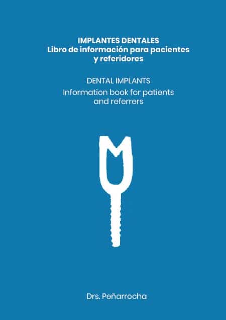 portada libro implantes dentales idim clinica de implantes dentales en valencia