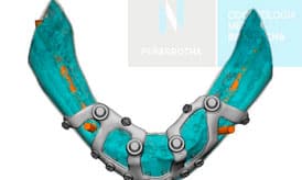 proceso de los implantes subperiosticos IDIM clinica de implantes dentales en valencia