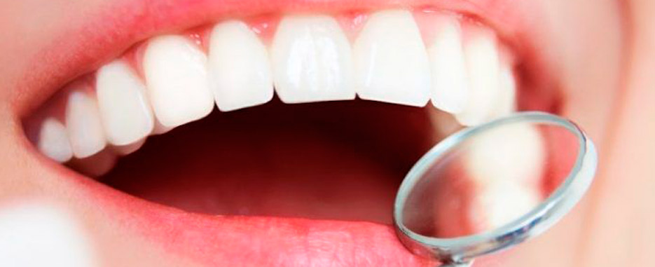 son comodos los implantes dentales