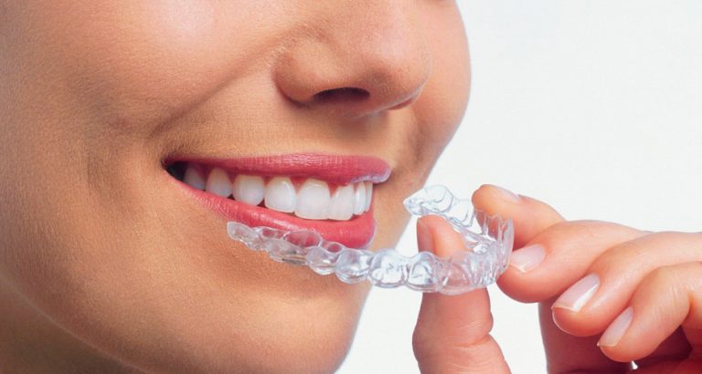 Algunas claves de la férula dental