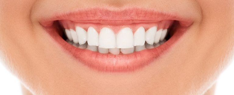 como eliminar el sarro de los dientes