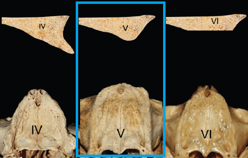 cuando estan indicados los implantes angulados idim clinica de implantes dentales en valencia