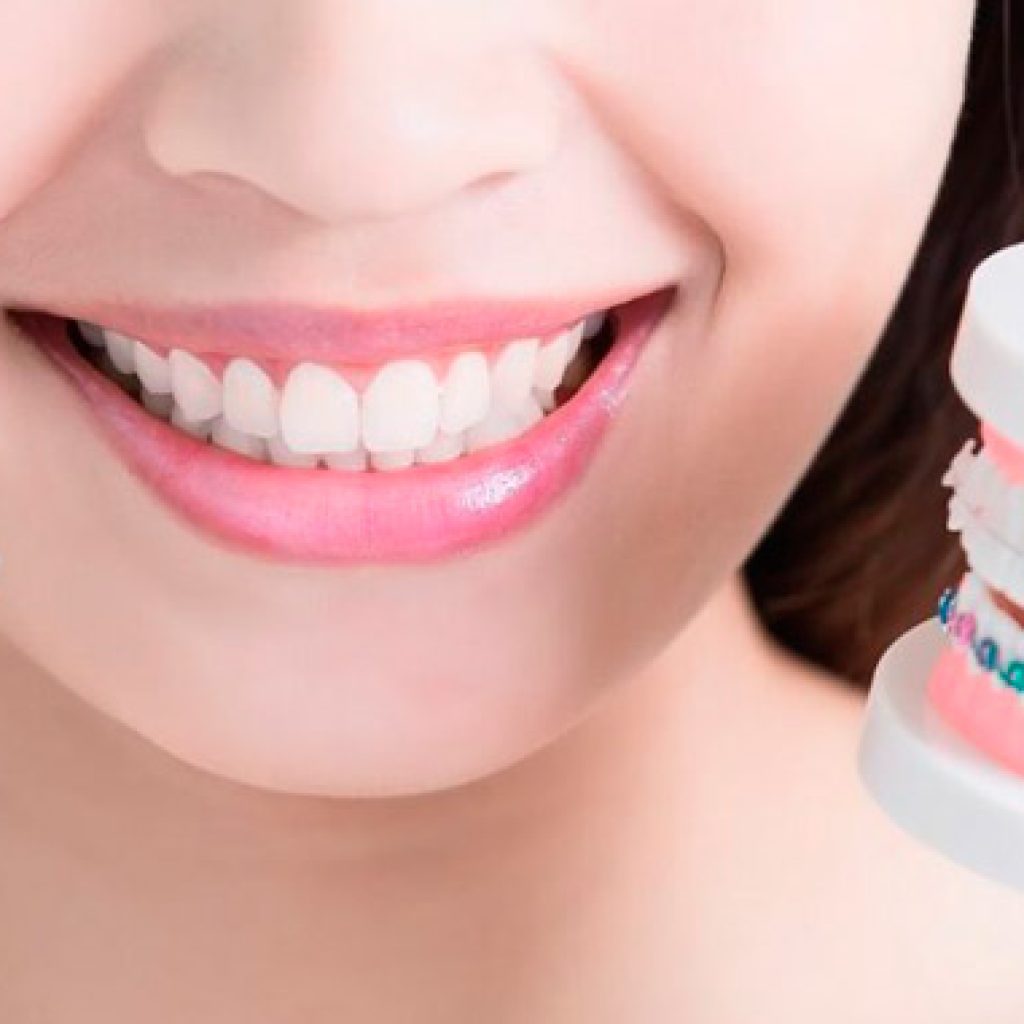 cuanto dura el tratamiento de invisalign