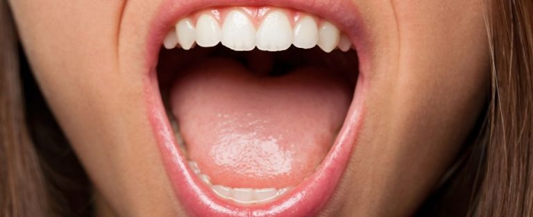 cuanto tarda en cicatrizar un implante dental