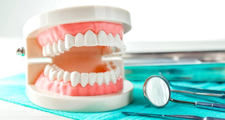 tipos de prótesis dentales