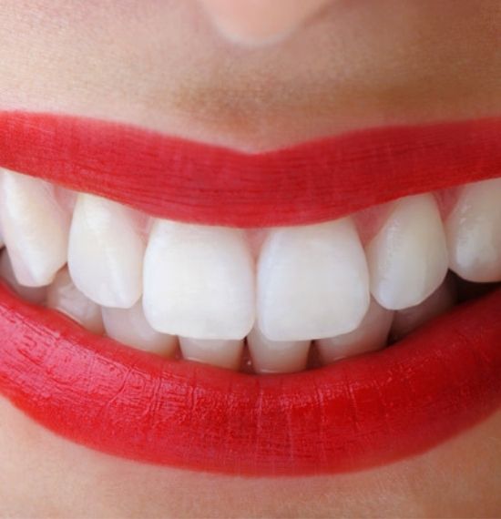 estética dental