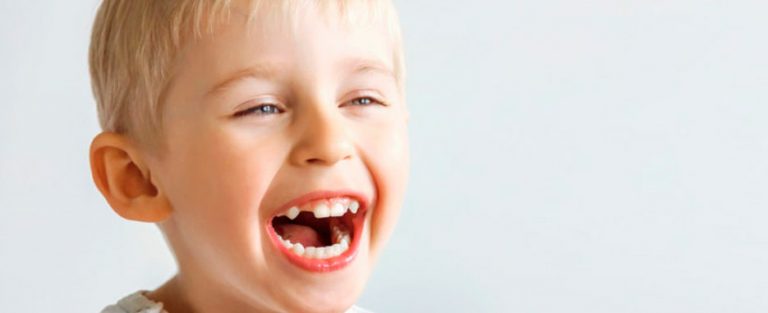 la agenesia dental o ausencia de dientes congenita