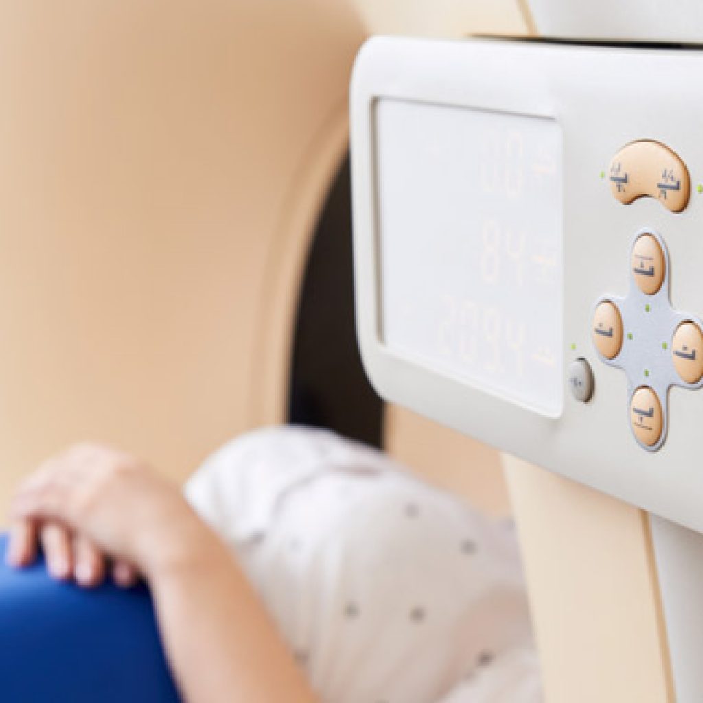 los implantes dentales compatibles con resonancia magnetica