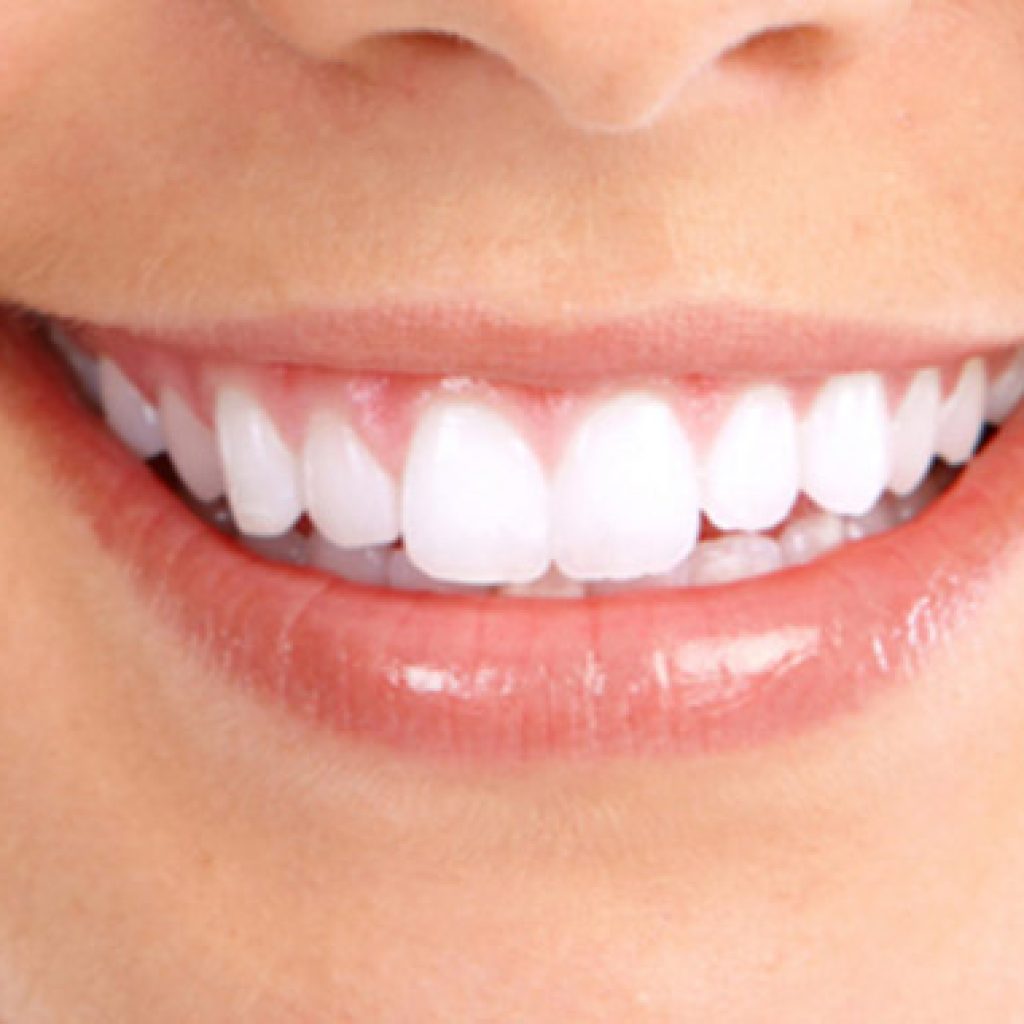 por que salen manchas blancas en los dientes
