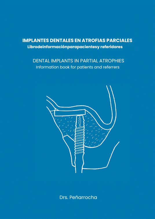 portada libro atrofias parciales